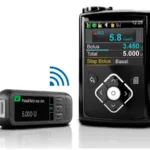 Novidades no tratamento do diabetes: falta pouco para o pâncreas artificial