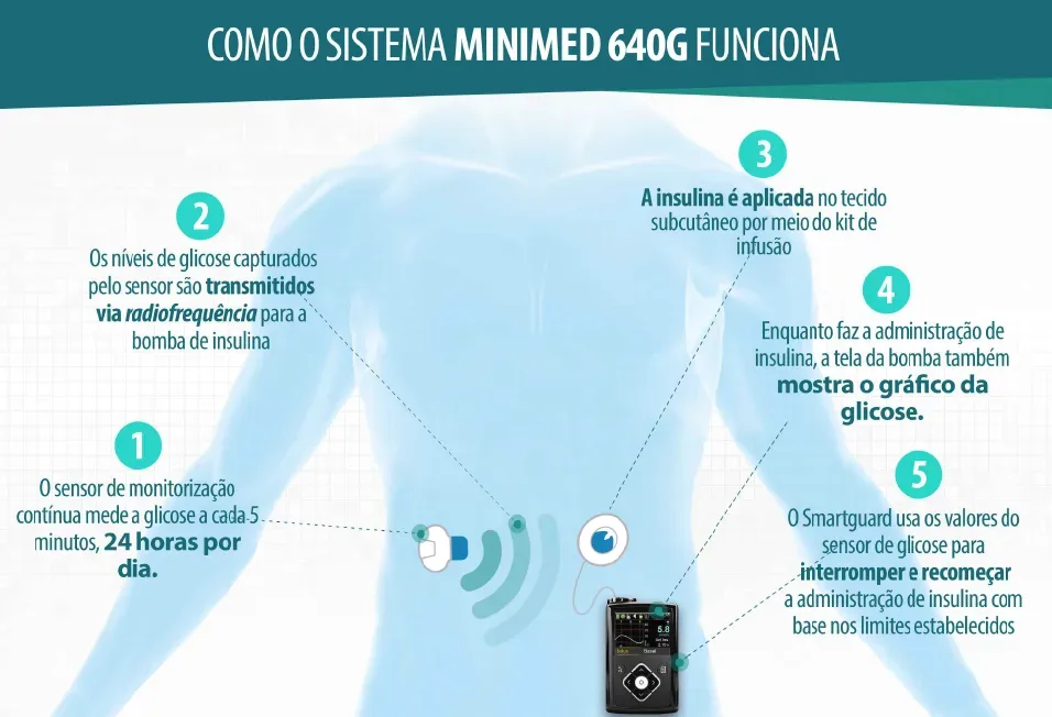 minimed 640g
